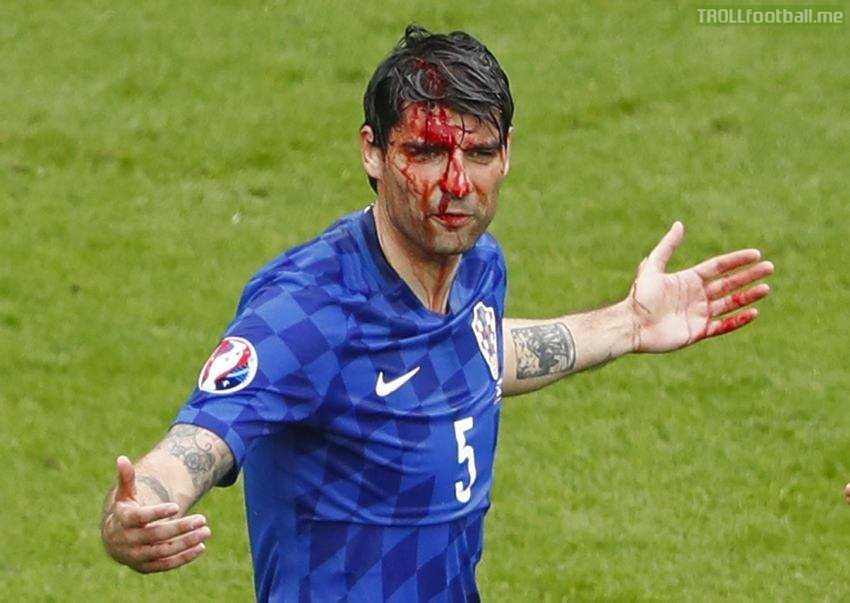 Vedran Čorluka after being hit by elbow - Croatia vs Turkey