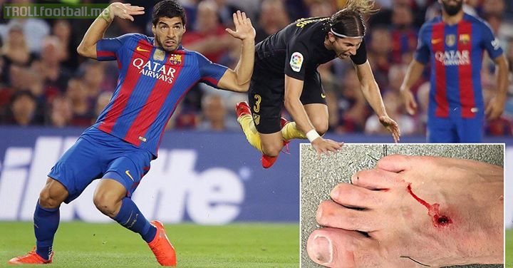 After Luis Suarez clearly fouled Filipe Luis he shouted: "You dived, you clown"