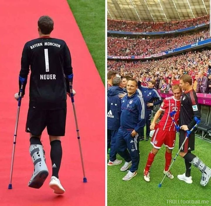 Even when Neuer's injured he can't stay in position. Peep the Yeezys btw.