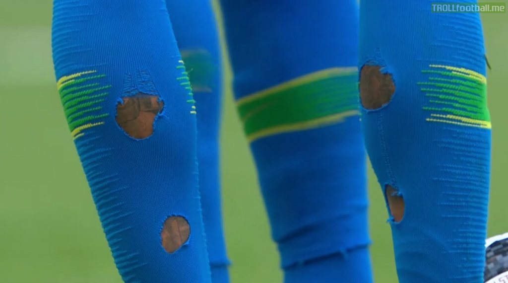 Neymar's socks after the game against Costa Rica.