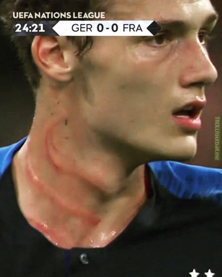 Pavard after the tackle against Rudigier at the Germany-France friendly
