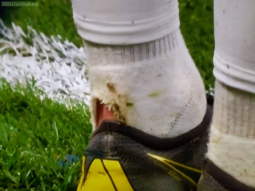 Eden Hazard's Achilles after 20 mins vs Slavia Prague (fouled twice by Kudela)