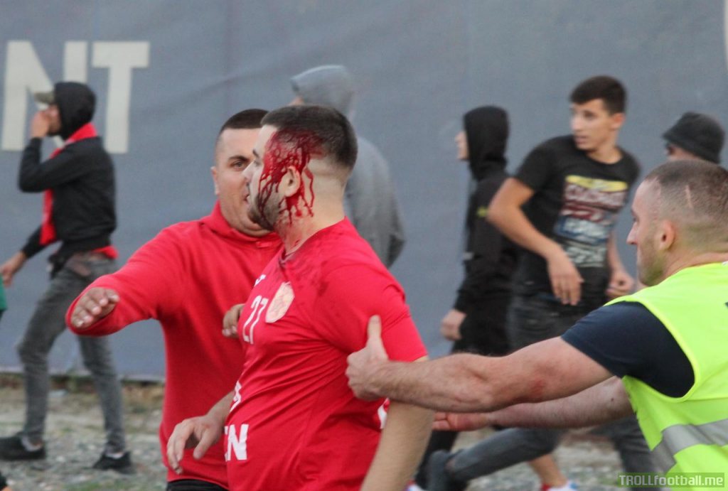 Bloody fight at "The Derby of capital" Tirana - Partizani.