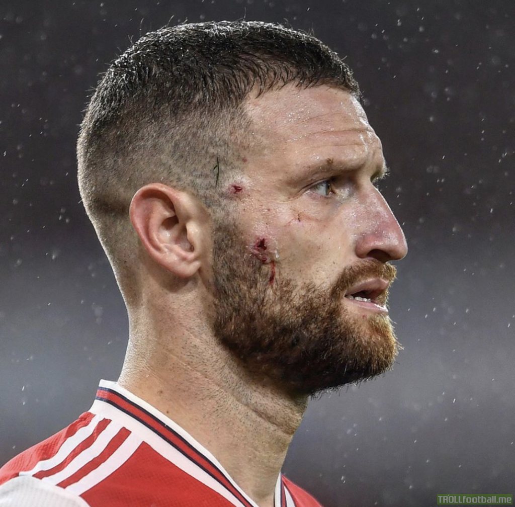Mustafi’s face after Vardy’s challenge.