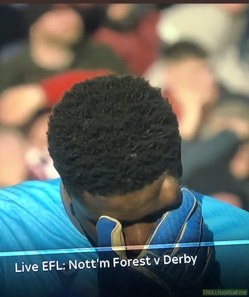 Nottingham Forest’s goalkeeper Brice Samba’s head after a collision during today’s fixture against Derby