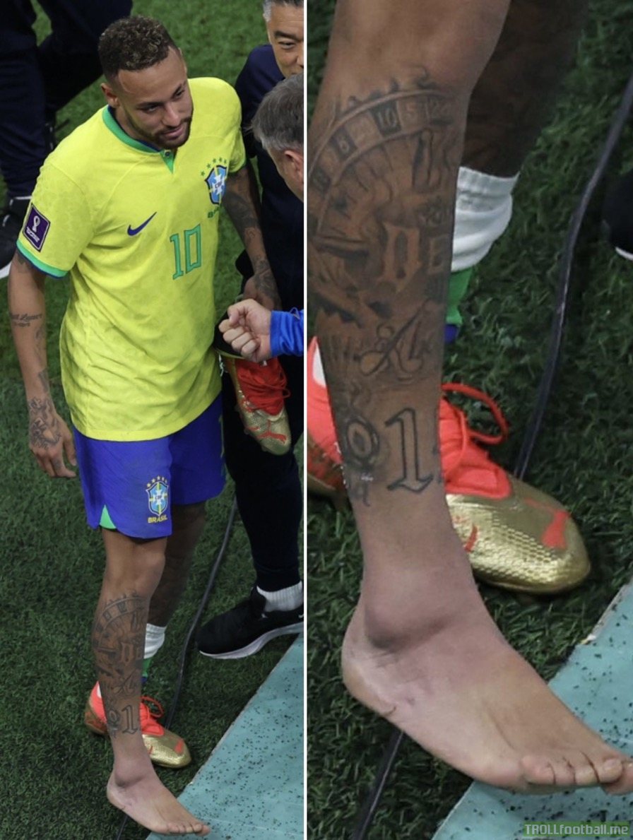 Neymar's ankle following the Brazil game