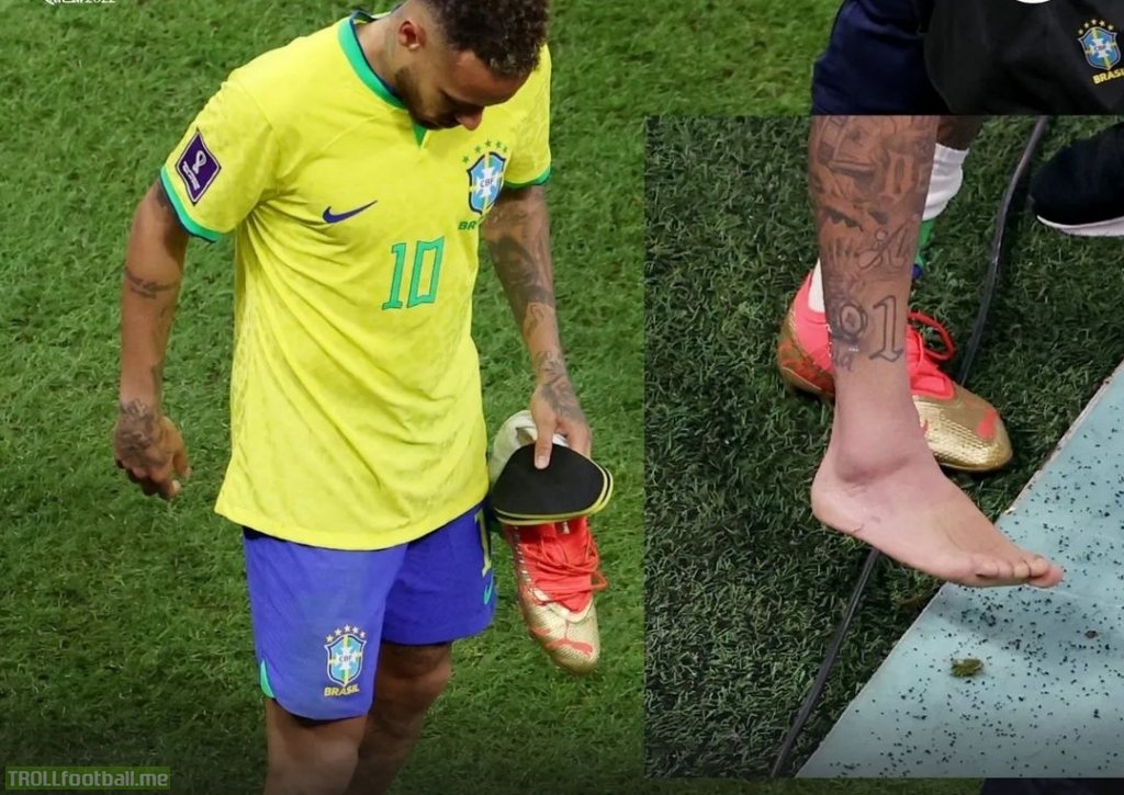 Neymar's ankle looks In bad shape